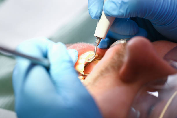 Emergency Dentist Open Today in CT