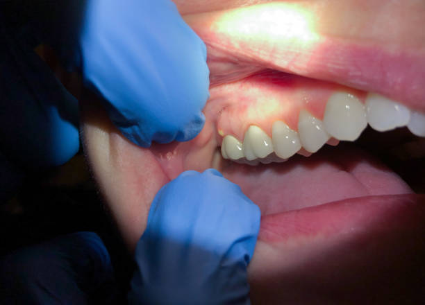 Best Tooth Infection Emergency Dentist  in Conning Towers Nautilus Park, CT